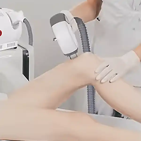 Aesthetic Laser Equipment