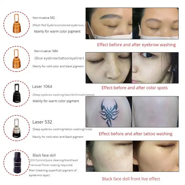 best picosecond tattoo removal machine for professionals front view