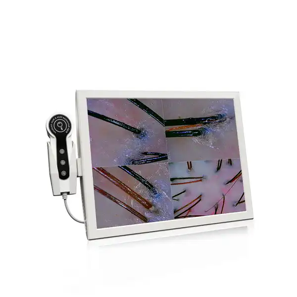 Hair Follicle Diagnostic Machine
