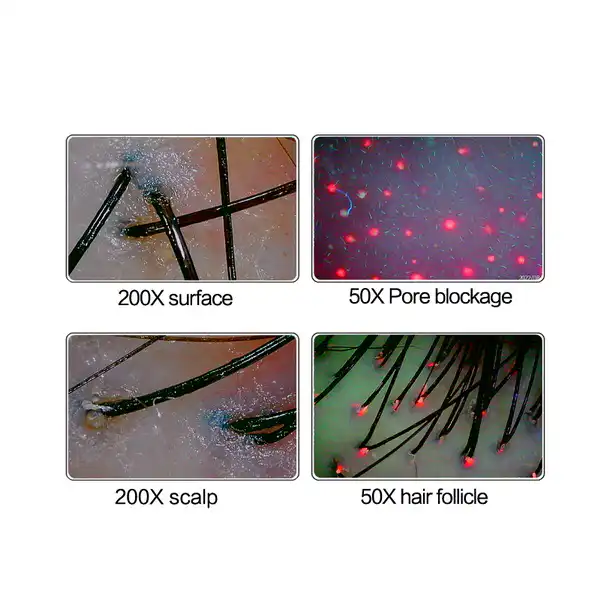 Hair Growth Diagnostic To