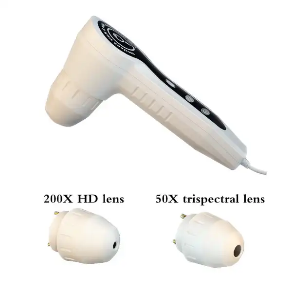 Scalp Analysis Device