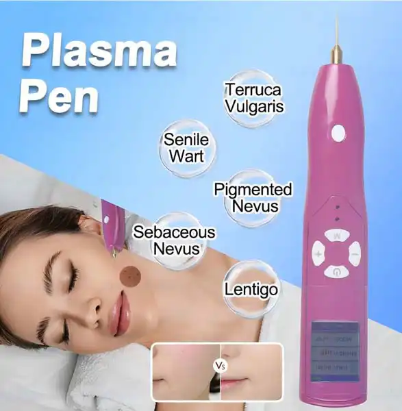 cold plasma pen noninvasive plasma pen