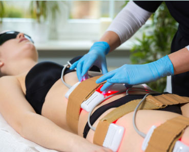 lipo laser machines