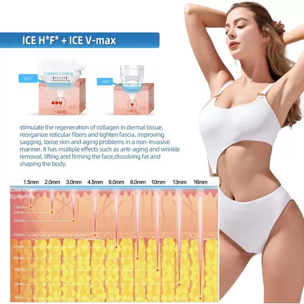 Ice V-Max Technology