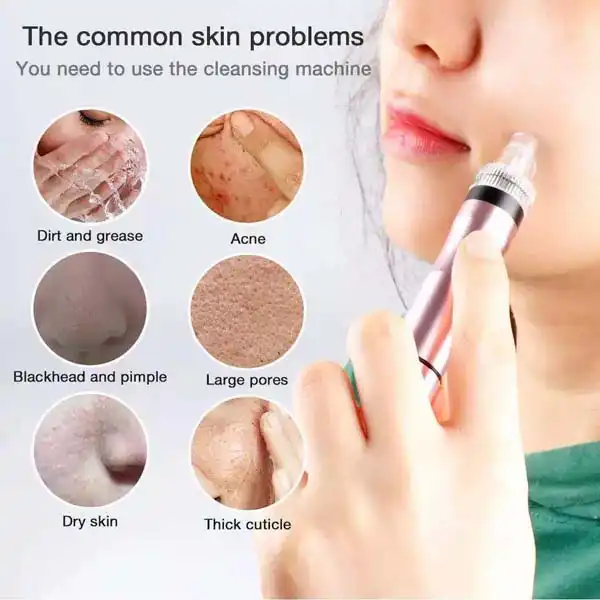 blackhead removal machine