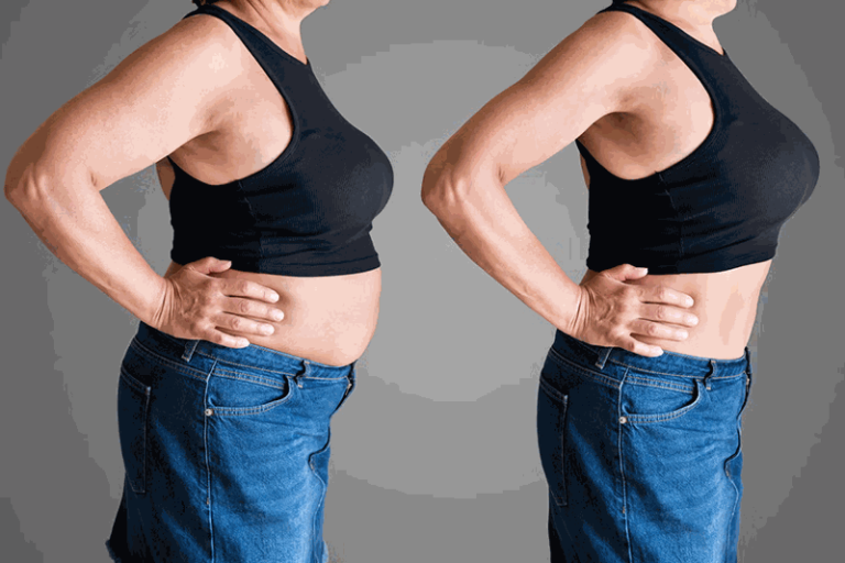 Before and after weight loss
