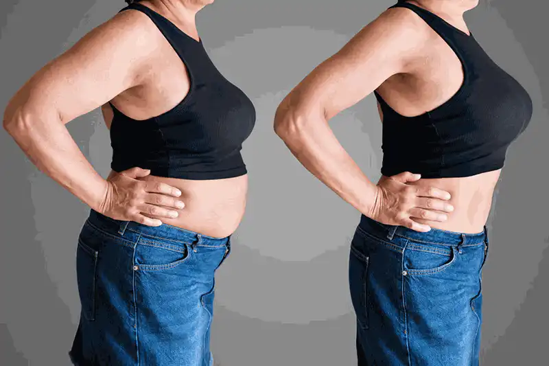 Before and after weight loss
